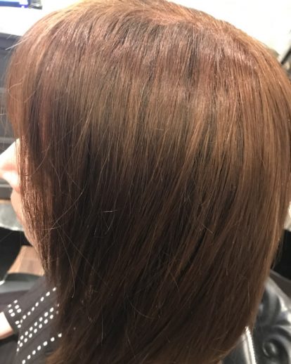 Custom Hair Loss Replacement Integration System