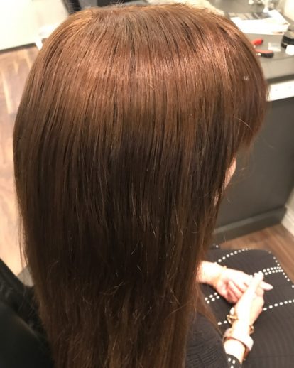 Custom Hair Loss Replacement Integration System